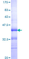 ITGA4 / VLA-4 / CD49d Protein - 12.5% SDS-PAGE Stained with Coomassie Blue.