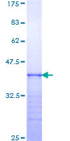 ITGA6/Integrin Alpha 6/CD49f Protein - 12.5% SDS-PAGE Stained with Coomassie Blue.