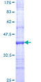 ITGA8 / Integrin Alpha 8 Protein - 12.5% SDS-PAGE Stained with Coomassie Blue.