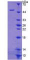 ITGA8 / Integrin Alpha 8 Protein - Recombinant  Integrin Alpha 8 By SDS-PAGE
