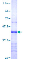 ITGA9 / Integrin Alpha 9 Protein - 12.5% SDS-PAGE Stained with Coomassie Blue.