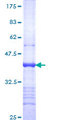 ITGA9 / Integrin Alpha 9 Protein - 12.5% SDS-PAGE Stained with Coomassie Blue.
