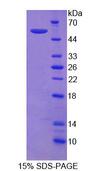 ITGA9 / Integrin Alpha 9 Protein - Recombinant  Integrin Alpha 9 By SDS-PAGE