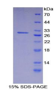ITGAD / CD11d Protein - Recombinant Integrin Alpha D By SDS-PAGE