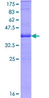 ITGAE / CD103 Protein - 12.5% SDS-PAGE Stained with Coomassie Blue.