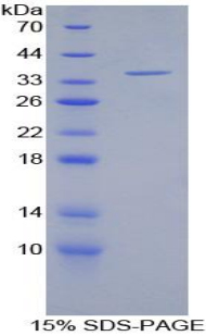 ITGAL / CD11a Protein - Recombinant Lymphocyte Function Associated Antigen 1 Alpha By SDS-PAGE