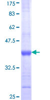 ITGAM / CD11b Protein - 12.5% SDS-PAGE Stained with Coomassie Blue.