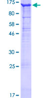 ITGAV/Integrin Alpha V/CD51 Protein - 12.5% SDS-PAGE of human ITGAV stained with Coomassie Blue