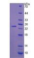 ITGAV/Integrin Alpha V/CD51 Protein - Recombinant Integrin Alpha V By SDS-PAGE