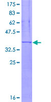 ITGAX / CD11c Protein - 12.5% SDS-PAGE Stained with Coomassie Blue.