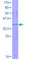 ITGAX / CD11c Protein - 12.5% SDS-PAGE Stained with Coomassie Blue.