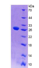 ITGAX / CD11c Protein - Recombinant Integrin Alpha X By SDS-PAGE