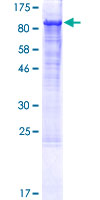 ITGB1 / Integrin Beta 1 / CD29 Protein - 12.5% SDS-PAGE of human ITGB1 stained with Coomassie Blue