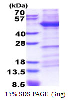 ITGB1 / Integrin Beta 1 / CD29 Protein