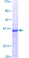 ITGB1BP1 / ICAP1 Protein - 12.5% SDS-PAGE of human ITGB1BP1 stained with Coomassie Blue