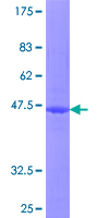 ITGB1BP1 / ICAP1 Protein - 12.5% SDS-PAGE of human ITGB1BP1 stained with Coomassie Blue