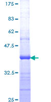 ITGB1BP1 / ICAP1 Protein - 12.5% SDS-PAGE Stained with Coomassie Blue.