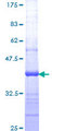 ITGB1BP1 / ICAP1 Protein - 12.5% SDS-PAGE Stained with Coomassie Blue.