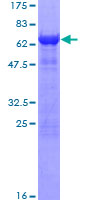 ITGB1BP2 / MELUSIN Protein - 12.5% SDS-PAGE of human ITGB1BP2 stained with Coomassie Blue