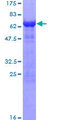 ITGB1BP2 / MELUSIN Protein - 12.5% SDS-PAGE of human ITGB1BP2 stained with Coomassie Blue