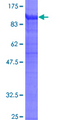 ITGB2 / CD18 Protein - 12.5% SDS-PAGE of human ITGB2 stained with Coomassie Blue