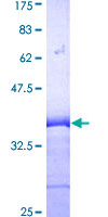 ITGB2 / CD18 Protein - 12.5% SDS-PAGE Stained with Coomassie Blue.