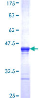 ITGB3BP Protein - 12.5% SDS-PAGE Stained with Coomassie Blue.