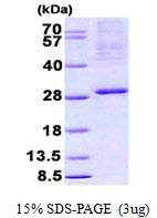 ITGB3BP Protein