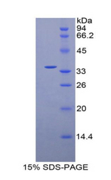 ITGB4 / Integrin Beta 4 Protein - Recombinant Integrin Beta 4 By SDS-PAGE