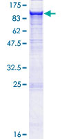ITGB5 / Integrin Beta 5 Protein - 12.5% SDS-PAGE of human ITGB5 stained with Coomassie Blue
