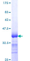 ITGB5 / Integrin Beta 5 Protein - 12.5% SDS-PAGE Stained with Coomassie Blue.