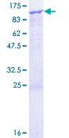 ITGB6 / Integrin Beta 6 Protein - 12.5% SDS-PAGE of human ITGB6 stained with Coomassie Blue