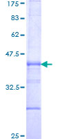ITGB6 / Integrin Beta 6 Protein - 12.5% SDS-PAGE Stained with Coomassie Blue.