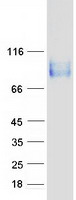 ITGB6 / Integrin Beta 6 Protein - Purified recombinant protein ITGB6 was analyzed by SDS-PAGE gel and Coomassie Blue Staining