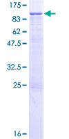 ITGB7 / Integrin Beta 7 Protein - 12.5% SDS-PAGE of human ITGB7 stained with Coomassie Blue