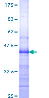 ITGB7 / Integrin Beta 7 Protein - 12.5% SDS-PAGE Stained with Coomassie Blue.