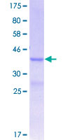 ITGB8 / Integrin Beta 8 Protein - 12.5% SDS-PAGE Stained with Coomassie Blue.