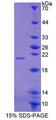 ITGB8 / Integrin Beta 8 Protein - Recombinant Integrin Beta 8 By SDS-PAGE