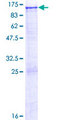 ITIH1 Protein - 12.5% SDS-PAGE of human ITIH1 stained with Coomassie Blue