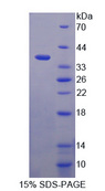 ITIH1 Protein - Recombinant  Inter Alpha-Globulin Inhibitor H1 By SDS-PAGE