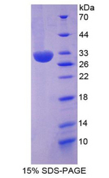 ITIH2 Protein - Recombinant Inter Alpha-Globulin Inhibitor H2 By SDS-PAGE