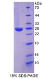 ITIH3 Protein - Recombinant Inter Alpha-Globulin Inhibitor H3 By SDS-PAGE