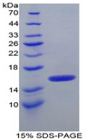ITIH4 Protein - Recombinant Inter Alpha-Globulin Inhibitor H4 By SDS-PAGE