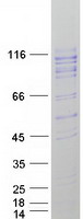 ITIH4 Protein - Purified recombinant protein ITIH4 was analyzed by SDS-PAGE gel and Coomassie Blue Staining