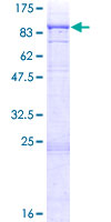ITK / EMT Protein - 12.5% SDS-PAGE of human ITK stained with Coomassie Blue