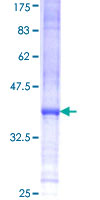 ITK / EMT Protein - 12.5% SDS-PAGE Stained with Coomassie Blue.