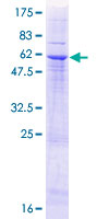 ITLN1 / Omentin Protein - 12.5% SDS-PAGE of human ITLN1 stained with Coomassie Blue