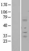 ITM2A Protein - Western validation with an anti-DDK antibody * L: Control HEK293 lysate R: Over-expression lysate