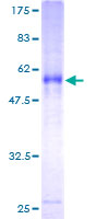 ITM2A Protein - 12.5% SDS-PAGE of human ITM2A stained with Coomassie Blue
