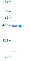 ITPA Protein - 12.5% SDS-PAGE of human ITPA stained with Coomassie Blue